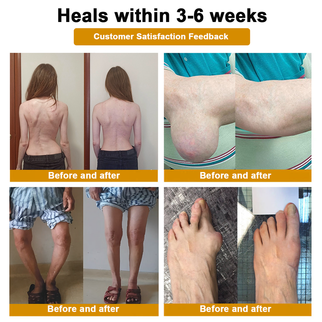 DR.HONOR® All-In-One Joint & Bone Recovery Cream🎉🎉(Specially for older adults)