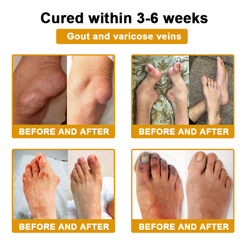 DR.HONOR® All-In-One Joint & Bone Recovery Cream🎉🎉(Specially for older adults)